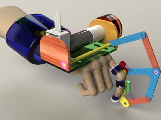 Visual for Design requirements for a tendon rehabilitation robot: results from a survey of engineers and health professionals
